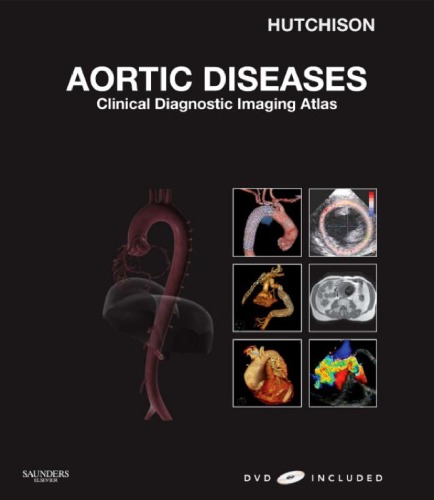 Aortic Diseases Clinical Diagnostic Imaging Atlas Cardiovascular Emergencies Atlas And Multimedia Stuart J Hutchison Md Frcpc Facc Faha Fase Fscmr Fscct