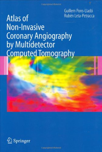 Atlas Of Noninvasive Coronary Angiography By Multidetector Computed Tomography Developments In Cardiovascular Medicine 1st Edition Guillem Ponsllado