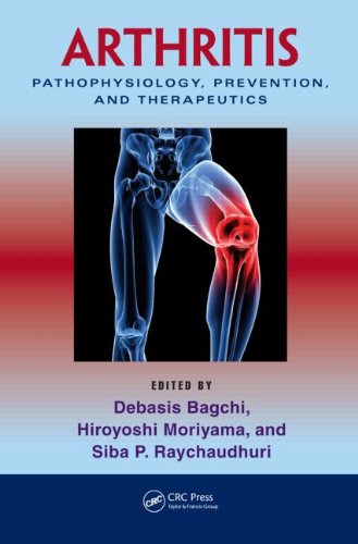 Arthritis Pathophysiology Prevention And Therapeutics 1st Edition Debasis Bagchi