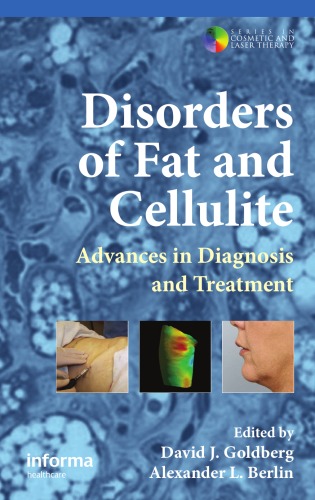 Disorders Of Fat And Cellulite Advances In Diagnosis And Treatment Series In Cosmetic And Laser Therapy 1st Edition David J Goldberg