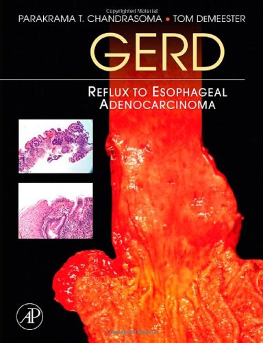 Gerd Reflux To Esophageal Adenocarcinoma 1st Edition Parakrama T Chandrasoma
