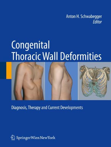 Congenital Thoracic Wall Deformities Diagnosis Therapy And Current Developments 1st Edition Anton H Schwabegger