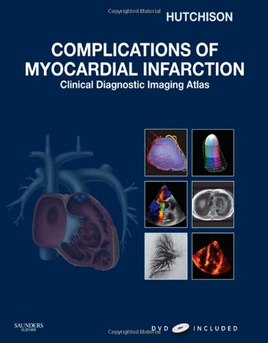 Complications Of Myocardial Infarction Clinical Diagnostic Imaging Atlas With Dvd Cardiovascular Emergencies Atlas And Multimedia 1 Hardvd Stuart J Hutchison Md Frcpc Facc Faha Fase Fscmr Fscct