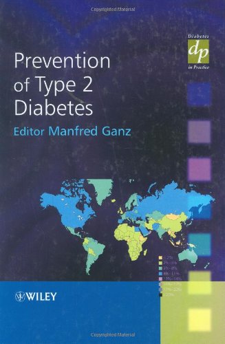 Prevention Of Type 2 Diabetes 1st Edition Manfred Ganz