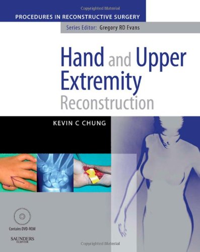 Hand And Upper Extremity Reconstruction Kevin C Chung Md Ms