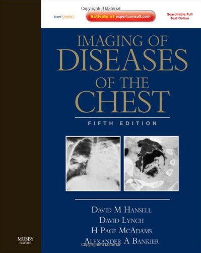 Imaging Of Diseases Of The Chest 5th Edition 5th Edition David M Hansell