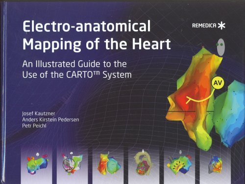 Electroanatomical Mapping Of The Heart An Illustrated Guide To The Use Of The Carto System 1 Harcdr Josef