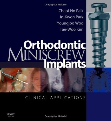 Orthodontic Miniscrew Implants Clinical Applications 1st Edition Cheolho Paik Dds Phd Facd