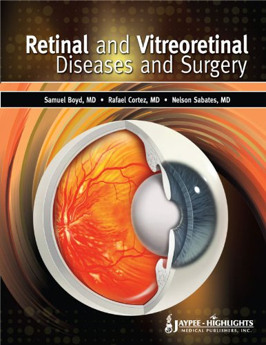 Retinal And Vitreoretinal Diseases And Surgery Boyd S
