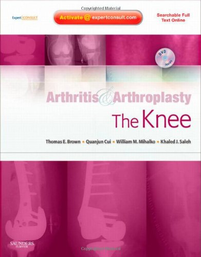 Arthritis And Arthroplasty The Knee 1 Hardvd Thomas E Brown