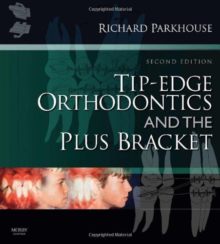 Tipedge Orthodontics And The Plus Bracket 2nd Edition Richard Parkhouse Bdshons Lond Fds Dorth Rcseng