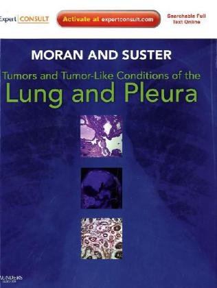 Tumors And Tumorlike Conditions Of The Lung And Pleura Expert Consult Online And Print 1 Harpsc Cesar A Moran Md