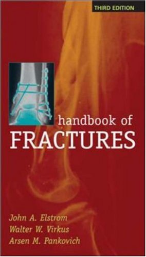 Handbook Of Fractures 3rd Edition 3rd Edition John A Elstrom