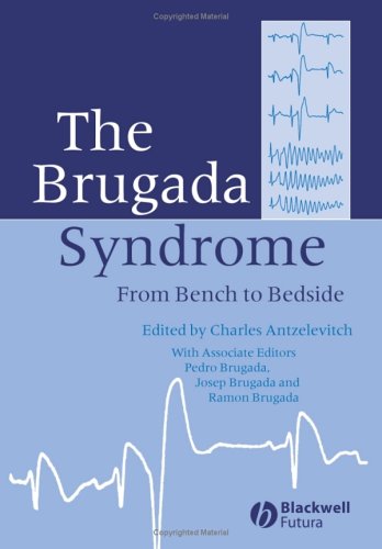 The Brugada Syndrome From Bench To Bedside Charles Antzelevitch