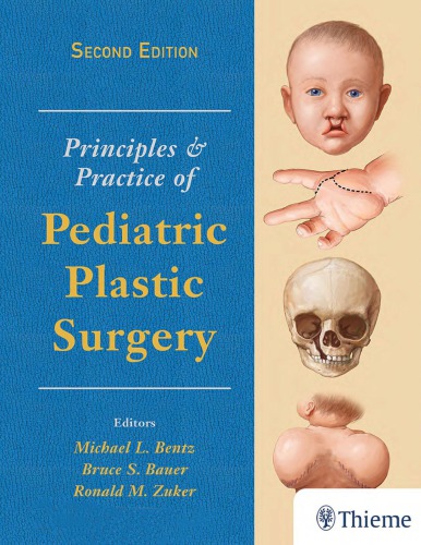 Principles Practice Of Pediatric Plastic Surgery 2nd Ed Bentz