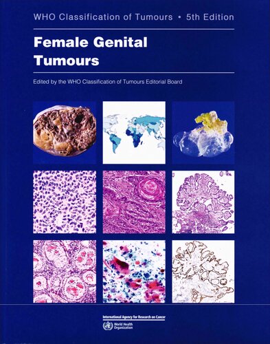 Who Classification Of Female Genital Tumours Who Classification Of Tumours World Health Organization Classification Of Tumours 5th Ed 2020 International Agency For Research On Cancer