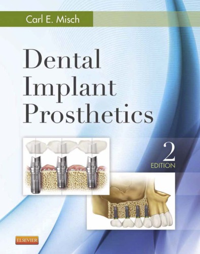 Dental Implant Prosthetics 2 Ed Carl E Misch