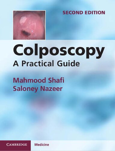 Colposcopy A Practical Guide 2nd Edition Mahmood Shafi Saloney Nazeer