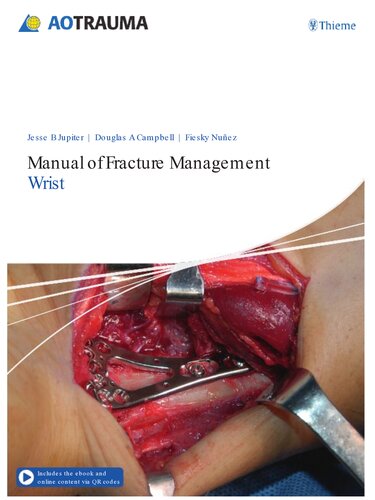 Manual Of Fracture Management Wrist Jesse B Jupiter Doug A Campbell Fiesky A Nunez