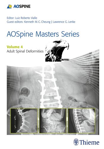 Aospine Masters Series Volume 4 Adult Spinal Deformities Luiz Roberto Vialle Lawrence Lenke Kenneth M C Cheung
