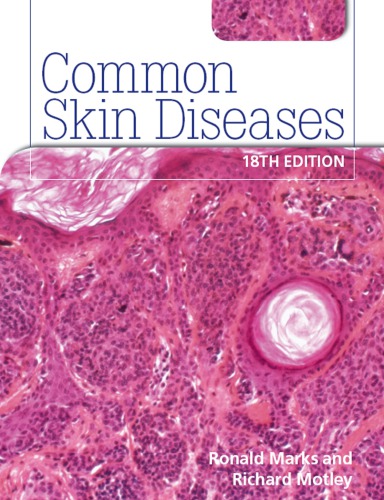 Common Skin Diseases 18th Edition Motley Richard