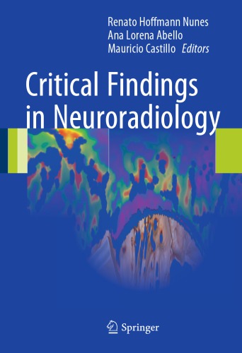 Critical Findings In Neuroradiology Renato Hoffmann Nunes Ana Lorena Abello
