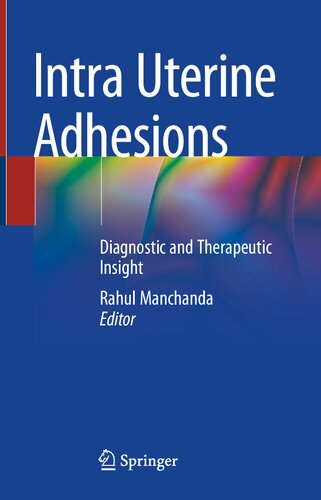 Intra Uterine Adhesions Diagnostic And Therapeutic Insight Rahul Manchanda