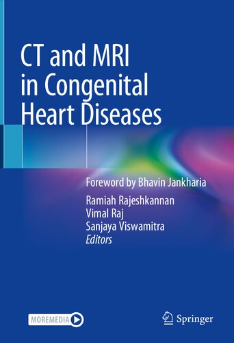 Ct And Mri In Congenital Heart Diseases Ramiah Rajeshkannan Vimal Raj
