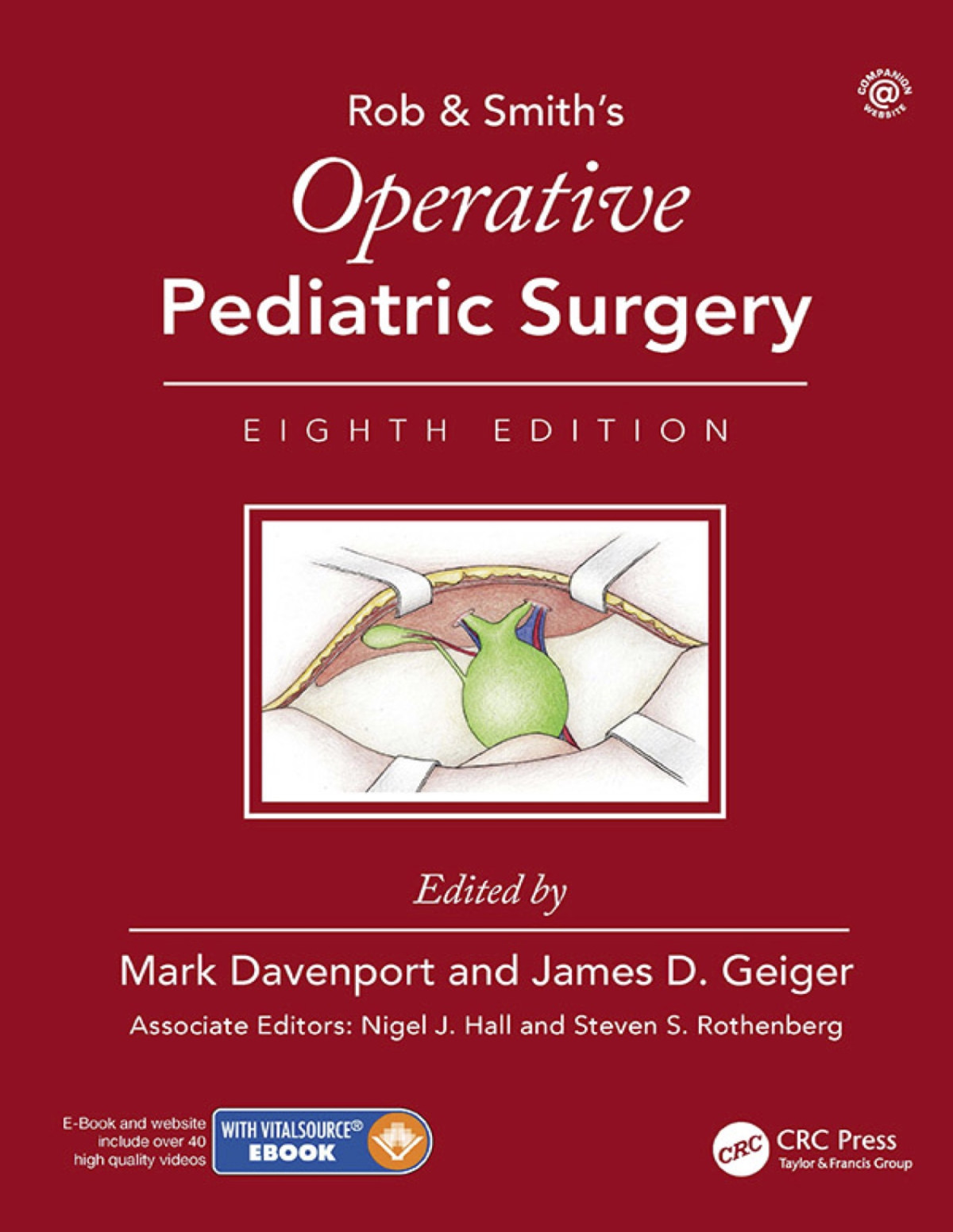 Rob Smiths Operative Pediatric Surgery 8th Edition Mark Davenport