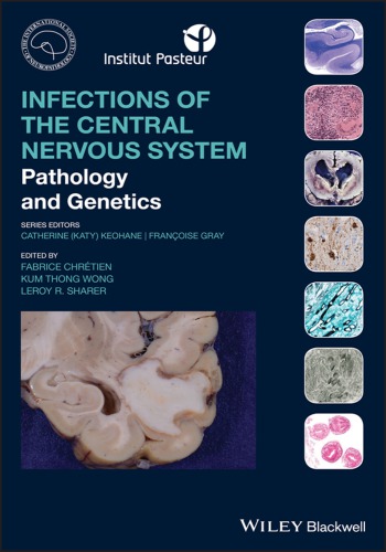 Infections Of The Central Nervous System Pathology And Genetics Fabrice Chretien