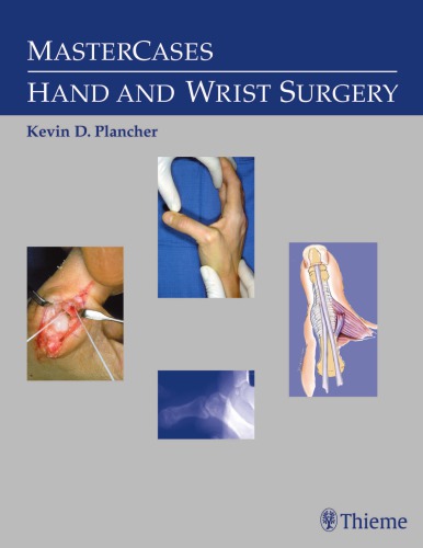 Mastercases In Hand And Wrist Surgery Plancher Kevineditorkozin