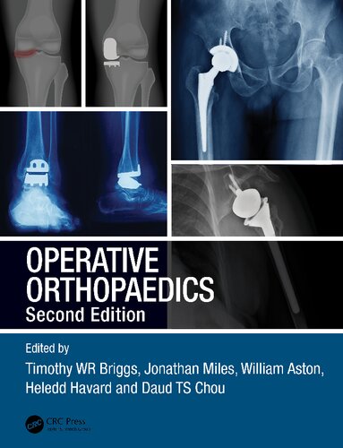 Operative Orthopaedics 2nd Edition Timothy Wr Briggs Jonathan Miles