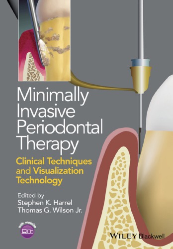 Minimally Invasive Periodontal Therapy Clinical Techniques And Visualization Technology Harrel