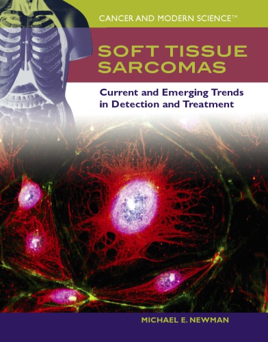 Soft Tissue Sarcomas Current And Emerging Trends In Detection And Treatment Newman