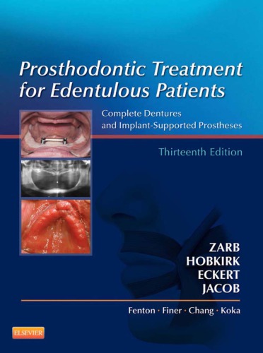 Prosthodontic Treatment For Edentulous Patients Complete Dentures And Implantsupported Prostheses 13th Edition Zarb