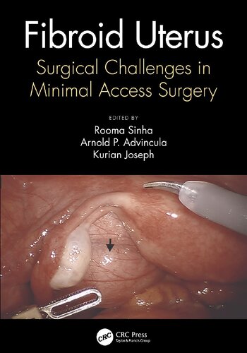 Fibroid Uterus Surgical Challenges In Minimal Access Surgery Rooma Sinha