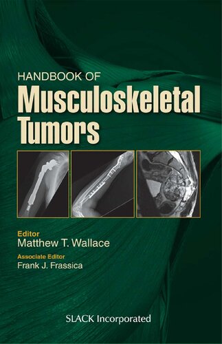 Handbook Of Musculoskeletal Tumors Matthew T Wallace Frank J Frassica