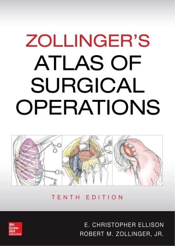 Zollingers Atlas Of Surgical Operations 10th Edition Zollinger