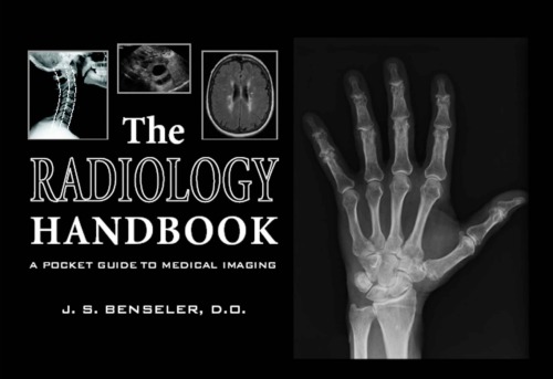The Radiology Handbook A Pocket Guide To Medical Imaging 1st J S Benseler