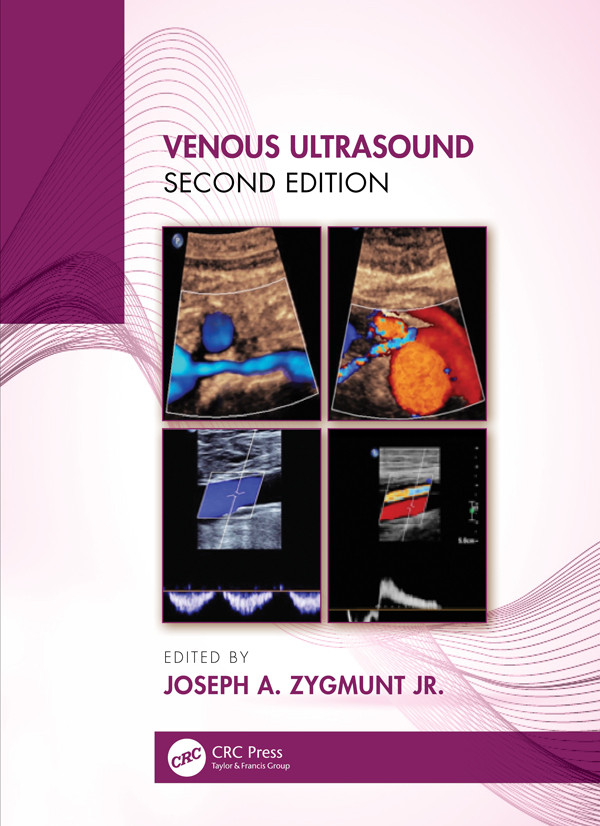 Venous Ultrasound Second Edition Zygmunt Joseph