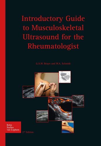 Introductory Guide To Musculoskeletal Ultrasound For The Rheumatologist 2nd Edition Wa Schmidt