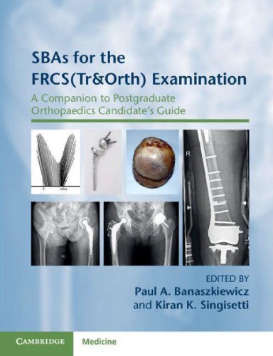 Sbas For The Frcstrorth Examination A Companion To Postgraduate Orthopaedics Candidates Guide 1st Paul A Banaszkiewicz