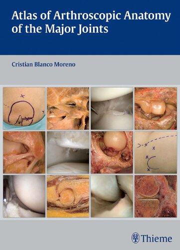 Atlas Of Arthroscopic Anatomy Of The Major Joints 1st Edition Cristian Blanco Moreno