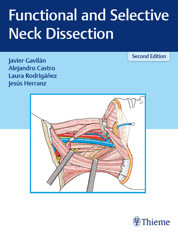 Functional And Selective Neck Dissection Javier Gavilnalejandro Castrolaura Rodrignez