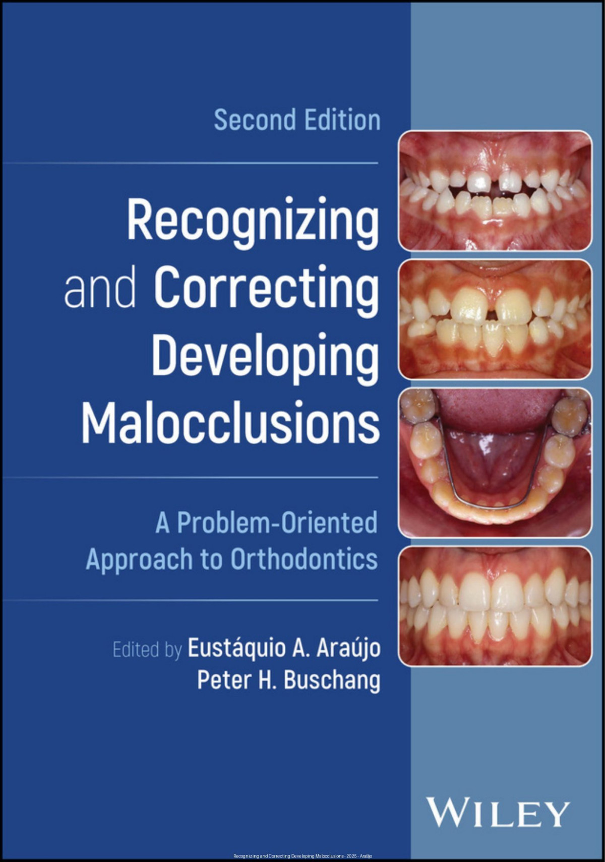 Recognizing And Correcting Developing Malocclusions A Problemoriented Approach To Orthodontics 2nd Edition Eustquio A Arajo Peter H Buschang