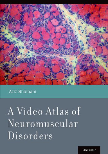 A Video Atlas Of Neuromuscular Disorders 1st Edition Aziz Shaibani