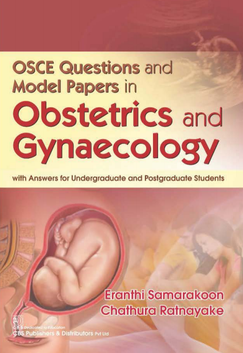 Osce Questions And Model Papers In Obstetrics And Gynaecology Double Paged 1st Edition Eranthi Samarakoon