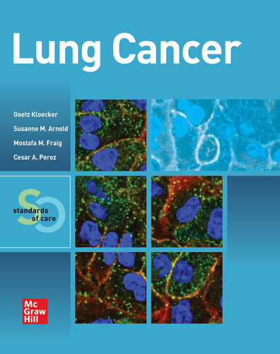 Lung Cancer Standards Of Care Goetz Kloecker Susanne M Arnold