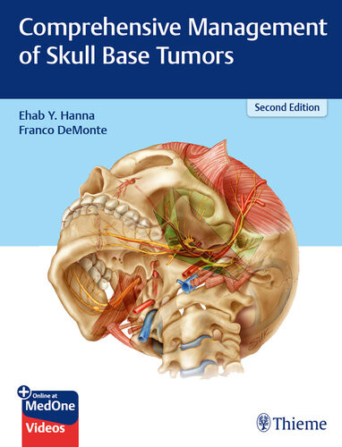 Comprehensive Management Of Skull Base Tumors 2nd Edition Ehab Y Hanna