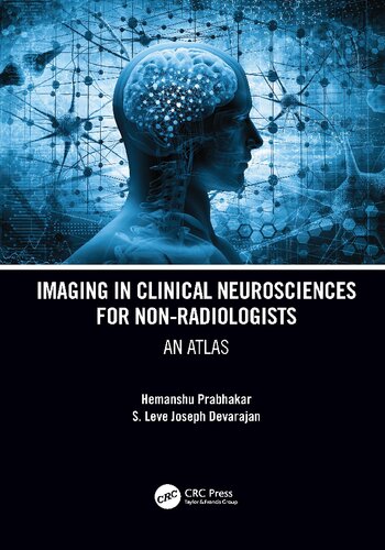 Imaging In Clinical Neurosciences For Nonradiologists An Atlas Hemanshu Prabhakar